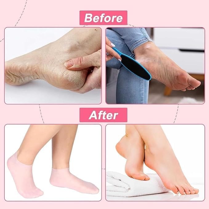 Silicone Gel Moisturizing Socks for Cracked Heels – Reusable Hydrating Spa Socks for Dry Feet, Heels & Callus Repair (Pack of 1 Pair-Random Skin tone color)